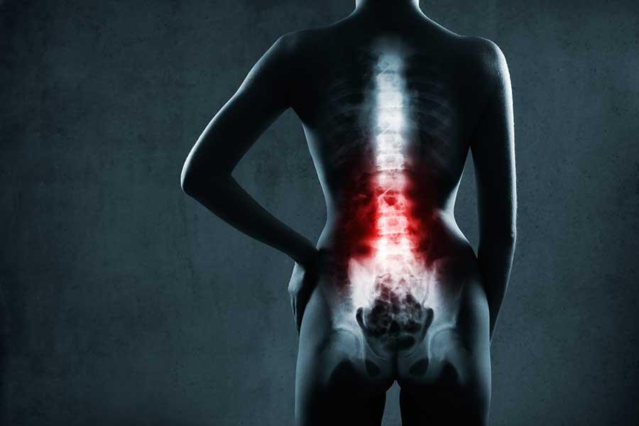 Preparing for Back Surgery Supply Physical Therapy