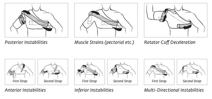 DonJoy® Sully Shoulder Stabilizer Brace - 11-0525-1 DonJoy® Sully Shoulder Stabilizer Brace - undefined by Supply Physical Therapy DonJoy, Donjoy Performance, Shoulder, Shoulder Brace, Sports Bracing, Stabilizers